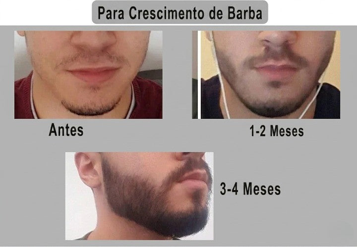 Beard Roller DRS 540 Agulhas