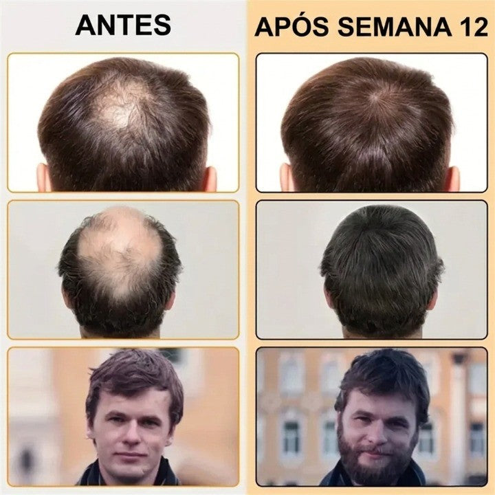 Sérum de Crescimento com Biotina e Óleos Essenciais - Tratamento Anti-Queda Masculino