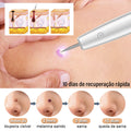 Caneta de Plasma Estético VivaGlow - imagem 6