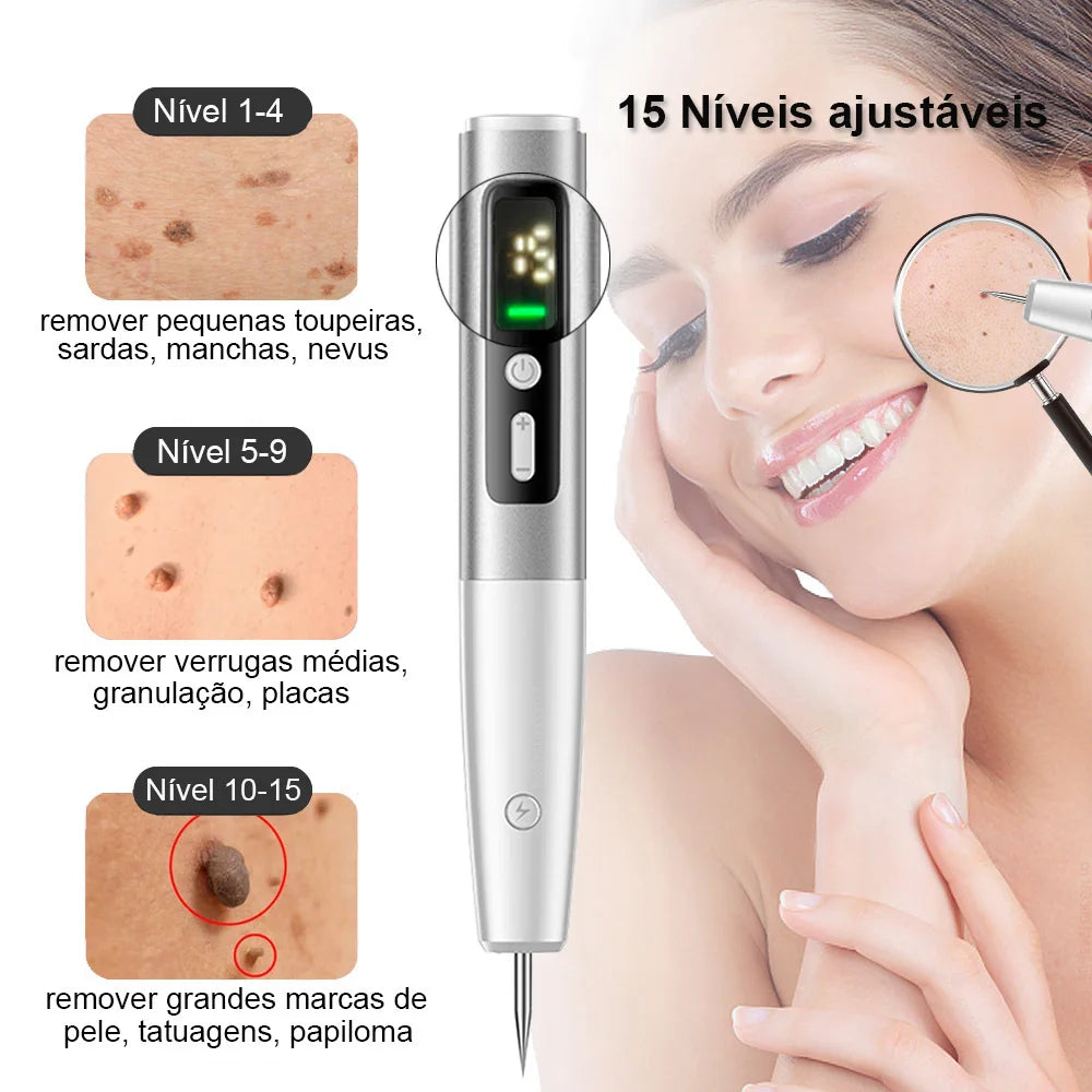 Caneta de Plasma Estético VivaGlow - imagem 4